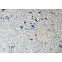 Новий Тон Тип 41