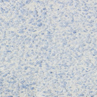 Рідкі шпалери Рельєф 326