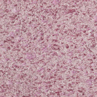 Рідкі шпалери Вікторія 713